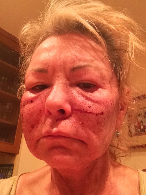 roseanne barr without makeup