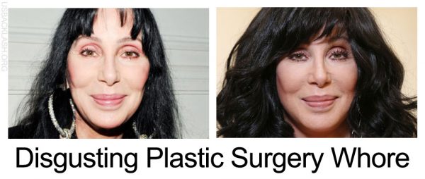 Stupid Plastic Surgery Whore Cher Attacks All Republicans As Homophobes