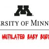University of Minnesota Bought Murdered Baby Body Parts From Baby Murder Mills